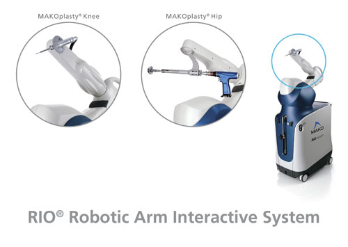 MAKO Rio Robotic Arm - Robotic Surgery